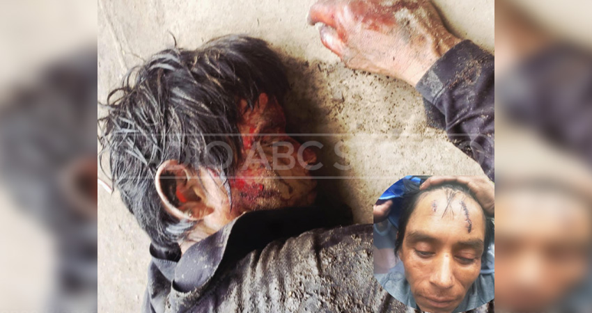 La víctima se agresión aún no puede trabajar, por su estado de salud. Foto: Cortesía/Radio ABC Stereo