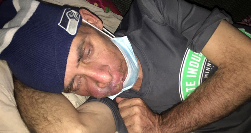 Luis Alfonso García sufre este padecimiento desde hace dos años. Foto: Alba Nubia Lira/Radio ABC Stereo Luis Alfonso García sufre este padecimiento desde hace dos años. Foto: Alba Nubia Lira/Radio ABC Stereo