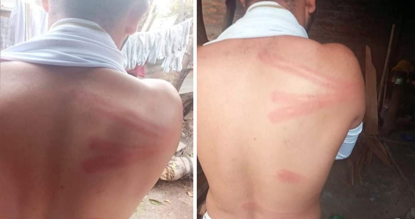 La víctima recibió golpes en el cuerpo. Foto: Juan Fco. Dávila/Radio ABC Stereo La víctima recibió golpes en el cuerpo. Foto: Juan Fco. Dávila/Radio ABC Stereo