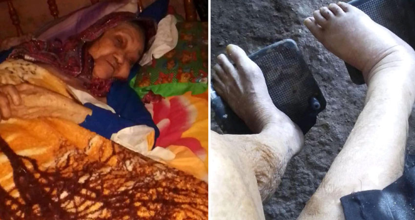 Necesita ayuda médica y económica. Foto: Cortesía/Radio ABC Stereo