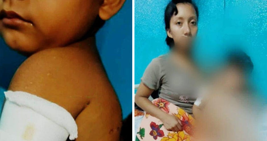 Perros pitbull atacaron a una mujer y su hijo. Foto: Cortesía/Radio ABC Stereo Perros pitbull atacaron a una mujer y su hijo. Foto: Cortesía/Radio ABC Stereo