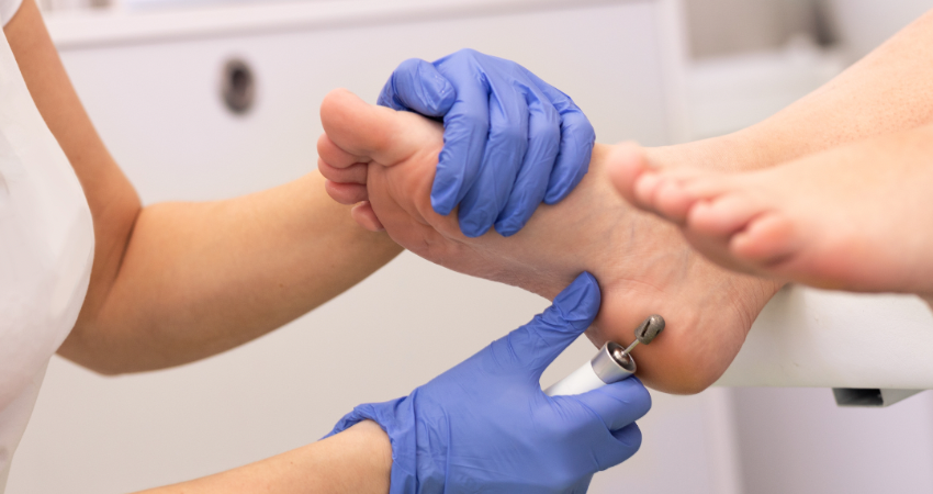 Este procedimiento clínico se diferencia de la pedicura estética. Foto de referencia. Este procedimiento clínico se diferencia de la pedicura estética. Foto de referencia.