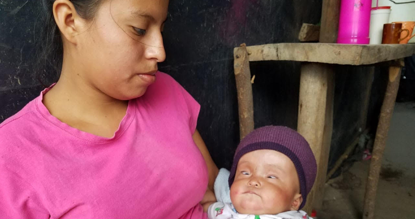 La niña será operada en Managua pero su familia necesita ayuda con algunos gastos. Foto: Denis García La niña será operada en Managua pero su familia necesita ayuda con algunos gastos. Foto: Denis García