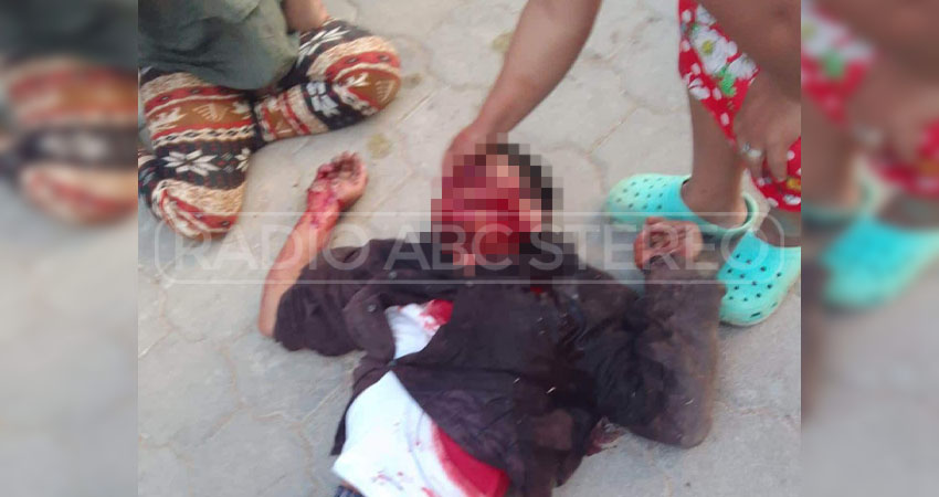 Aparentemente, el ataque ocurrió durante una pelea. Foto: Cortesía/Radio ABC Stereo Aparentemente, el ataque ocurrió durante una pelea. Foto: Cortesía/Radio ABC Stereo