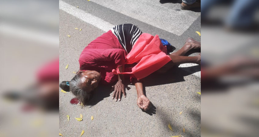 La señora Alejandra Mejía Ruiz fue atropellada por un motociclista. Foto: Marvin Gadea/Radio ABC Stereo