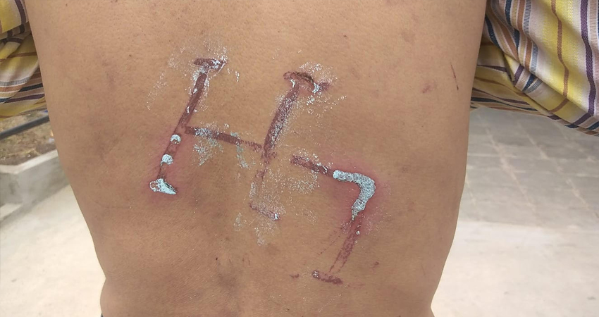 Inhumano acto de tortura. Foto: Juan Francisco Dávila / Radio ABC Stereo Inhumano acto de tortura. Foto: Juan Francisco Dávila / Radio ABC Stereo