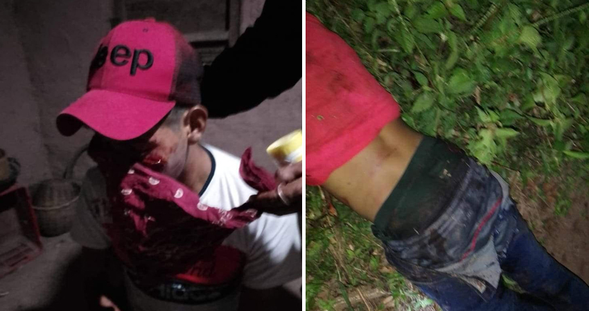 El hecho ocurrió en la comunidad La Montañita. Foto: Cortesía/Radio ABC Stereo El hecho ocurrió en la comunidad La Montañita. Foto: Cortesía/Radio ABC Stereo