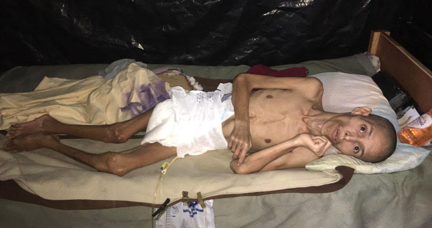 Hugo Zamora era cuidado por su humilde familia. Foto: Archivo / Radio ABC Stereo Hugo Zamora era cuidado por su humilde familia. Foto: Archivo / Radio ABC Stereo