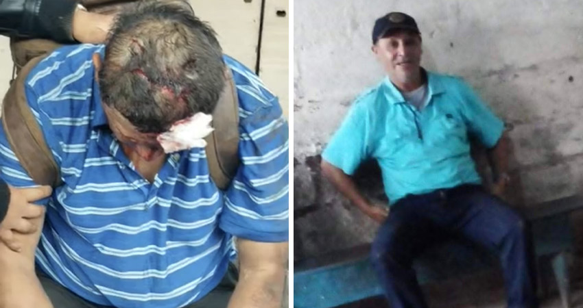 Pobladores auxiliaron a la víctima, pero los golpes recibidos fueron mortales. Foto: Cortesía/Radio ABC Stereo Pobladores auxiliaron a la víctima, pero los golpes recibidos fueron mortales. Foto: Cortesía/Radio ABC Stereo