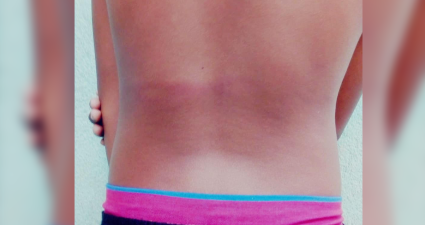 El niño resultó con golpes en la espalda. Foto: Cortesía/Radio ABC Stereo