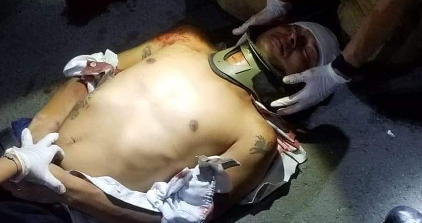 El motociclista tuvo que ser trasladado a Managua. Foto: Juan Fco. Dávila/Radio ABC Stereo