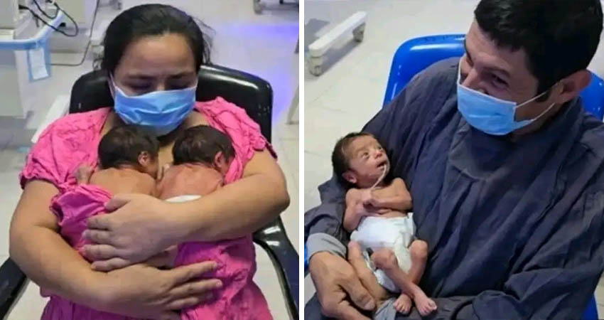 Nacen trillizos en Matagalpa. Foto: Cortesía/Radio ABC Stereo Nacen trillizos en Matagalpa. Foto: Cortesía/Radio ABC Stereo