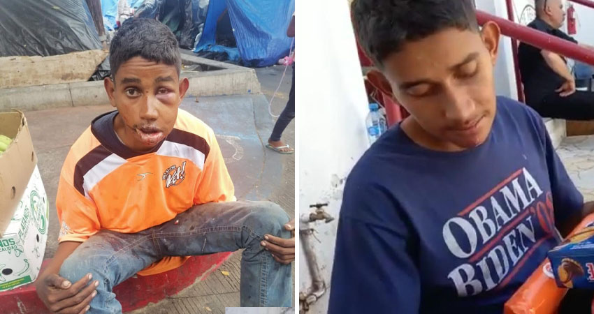 Tras la golpiza, el joven está en un centro de rehabilitación. Foto: Cortesía/Radio ABC Stereo Tras la golpiza, el joven está en un centro de rehabilitación. Foto: Cortesía/Radio ABC Stereo