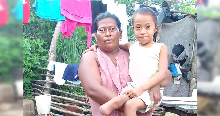 Tuvieron que amputarle su pierna al sufrir una rara enfermedad. Foto: Cortesía/Radio ABC Stereo