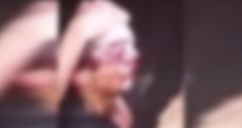 Elder José Valdivia Chavarría perdió el control de la moto e impactó contra un árbol. Foto: Cortesía/Radio ABC Stereo Elder José Valdivia Chavarría perdió el control de la moto e impactó contra un árbol. Foto: Cortesía/Radio ABC Stereo