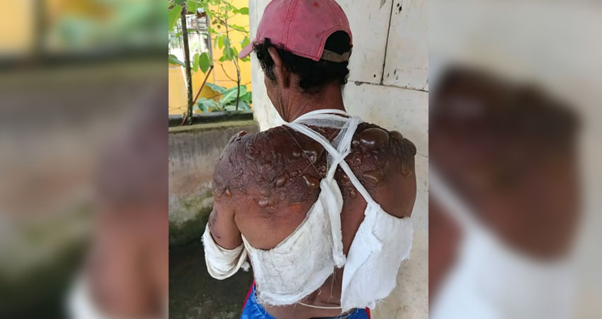 Danilo Alemán salvó dos vidas.      Foto: Cortesía / Radio ABC Stereo Danilo Alemán salvó dos vidas.      Foto: Cortesía / Radio ABC Stereo