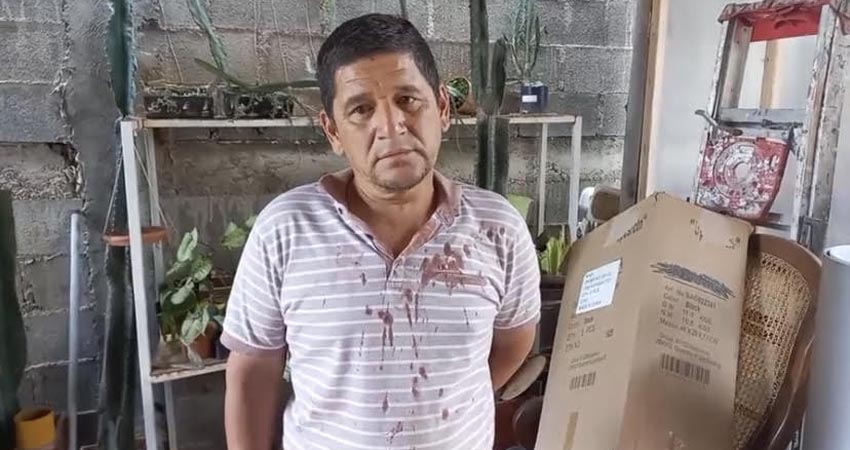 El afectado sufrió una herida en la cabeza y otra bajo la barba. Foto: Informativo 24/7 Jinotega El afectado sufrió una herida en la cabeza y otra bajo la barba. Foto: Informativo 24/7 Jinotega