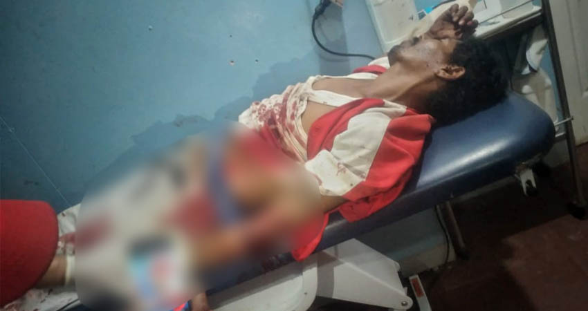 Francisco Cárcamo Rivera, herido con machete por su amigo de tragos. Foto: Denis García/Radio ABC Stereo Francisco Cárcamo Rivera, herido con machete por su amigo de tragos. Foto: Denis García/Radio ABC Stereo