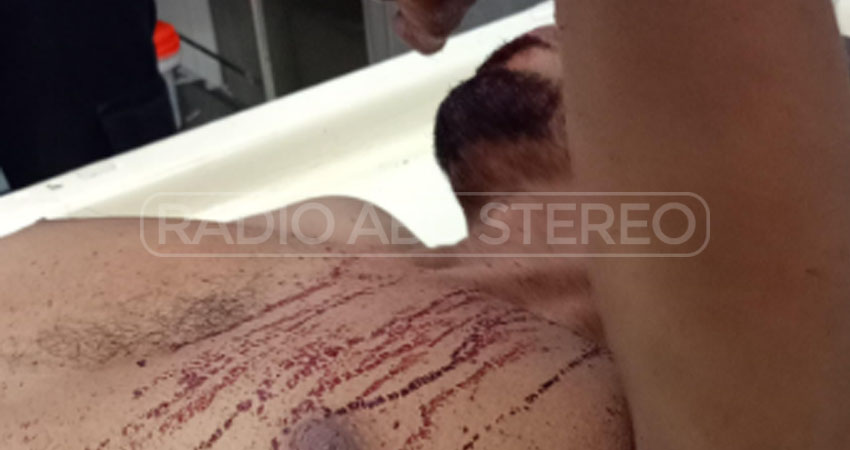 Hombre herido en Estelí. Foto: Cortesía/Radio ABC Stereo Hombre herido en Estelí. Foto: Cortesía/Radio ABC Stereo