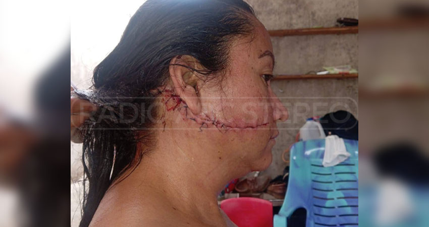 El hecho ocurrió en un bar de Mozonte. Foto: Cortesía/Radio ABC Stereo El hecho ocurrió en un bar de Mozonte. Foto: Cortesía/Radio ABC Stereo