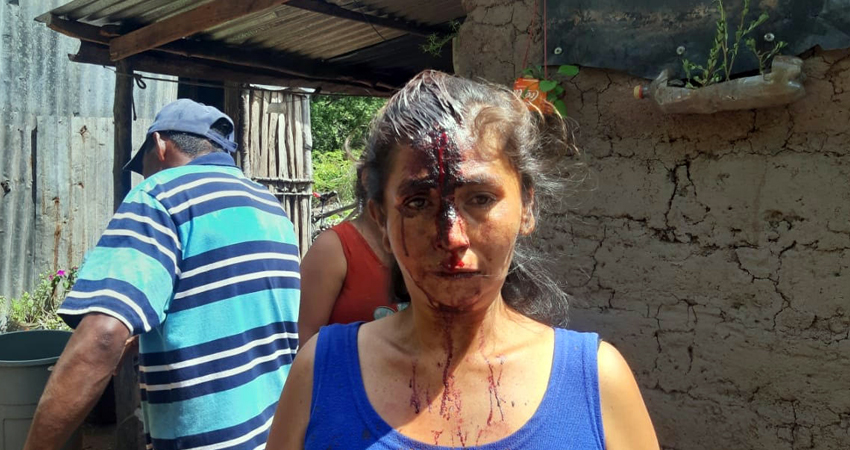 Judith del Carmen Valera asegura que teme por su vida. Foto: Cortesía/Radio ABC Stereo