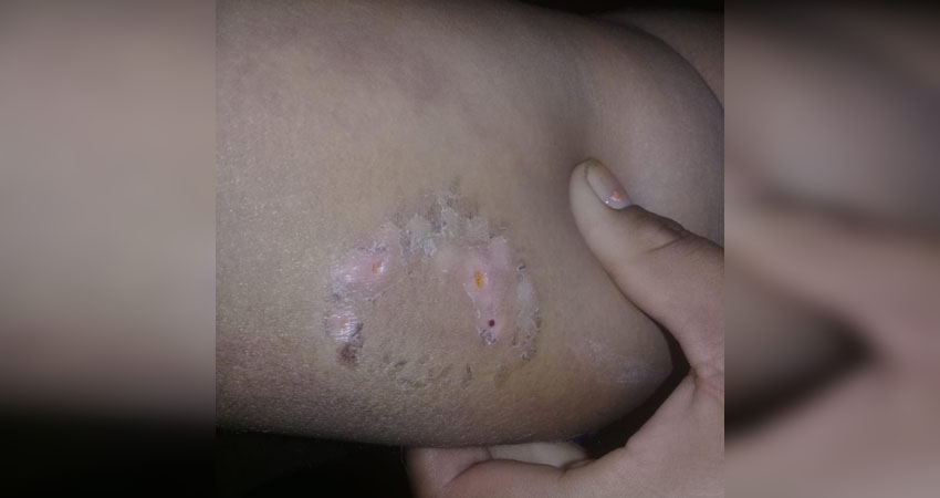 La denuncia ya fue interpuesta ante la policía. Foto: Cortesía/Radio ABC Stereo La denuncia ya fue interpuesta ante la policía. Foto: Cortesía/Radio ABC Stereo