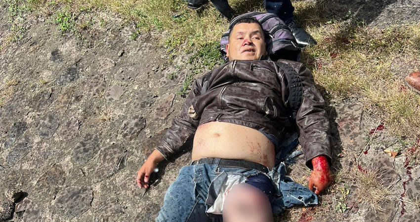 Fermín Herrera fue trasladado grave al hospital. Foto: Cortesía/Radio ABC Stereo Fermín Herrera fue trasladado grave al hospital. Foto: Cortesía/Radio ABC Stereo