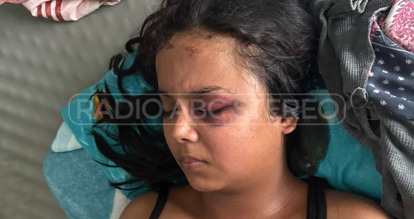 El sujeto le causó una lesión ocular de consideración a la víctima. Foto: Cortesía/Radio ABC Stereo El sujeto le causó una lesión ocular de consideración a la víctima. Foto: Cortesía/Radio ABC Stereo