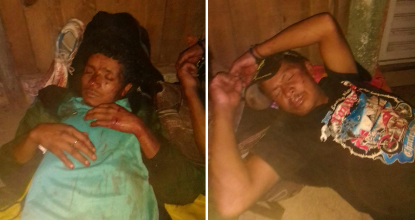 Las víctimas resultaron con lesiones en el rostro y resto del cuerpo. Foto: Juan Fco. Dávila/Radio ABC Stereo Las víctimas resultaron con lesiones en el rostro y resto del cuerpo. Foto: Juan Fco. Dávila/Radio ABC Stereo