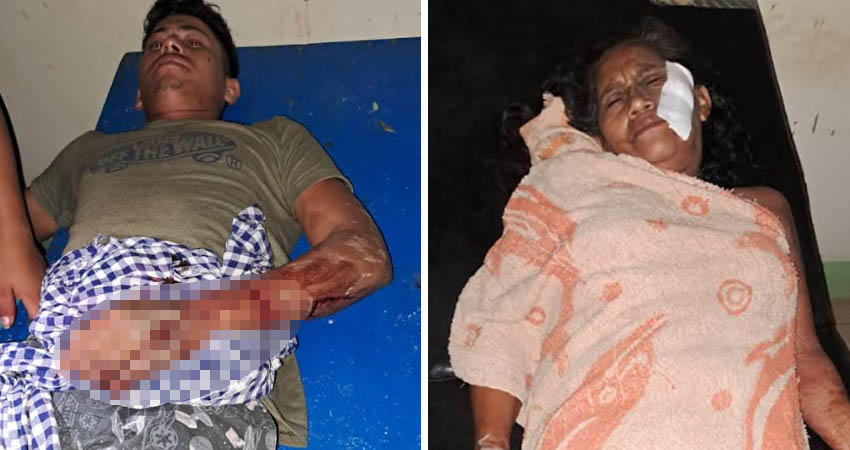 Los heridos fueron trasladados a un centro asistencial cercano. Foto: Cortesía/Radio ABC Stereo Los heridos fueron trasladados a un centro asistencial cercano. Foto: Cortesía/Radio ABC Stereo