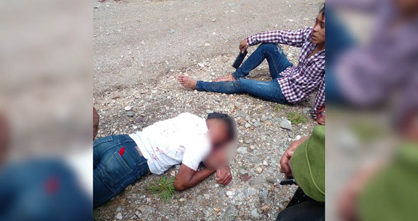 Melvin Paz sufrió una herida en su cabeza. Foto: Cortesía/Radio ABC Stereo Melvin Paz sufrió una herida en su cabeza. Foto: Cortesía/Radio ABC Stereo