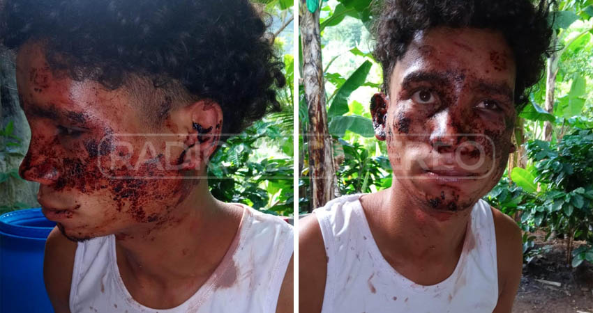 Kibian Espinoza, víctima de agresión. Foto: Cortesía Kibian Espinoza, víctima de agresión. Foto: Cortesía