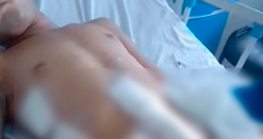 La víctima tuvo que ser remitida al hospital Héroes de las Segovias por la gravedad de sus heridas. Foto: Cortesía/Radio ABC Stereo La víctima tuvo que ser remitida al hospital Héroes de las Segovias por la gravedad de sus heridas. Foto: Cortesía/Radio ABC Stereo