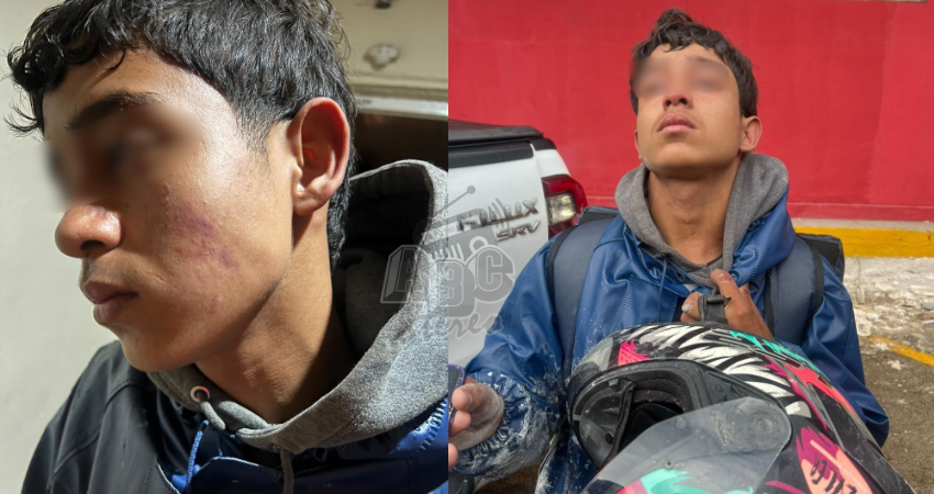 El adolescente sufrió lesiones en el rostro y cuello. Foto: Noticias ABC El adolescente sufrió lesiones en el rostro y cuello. Foto: Noticias ABC
