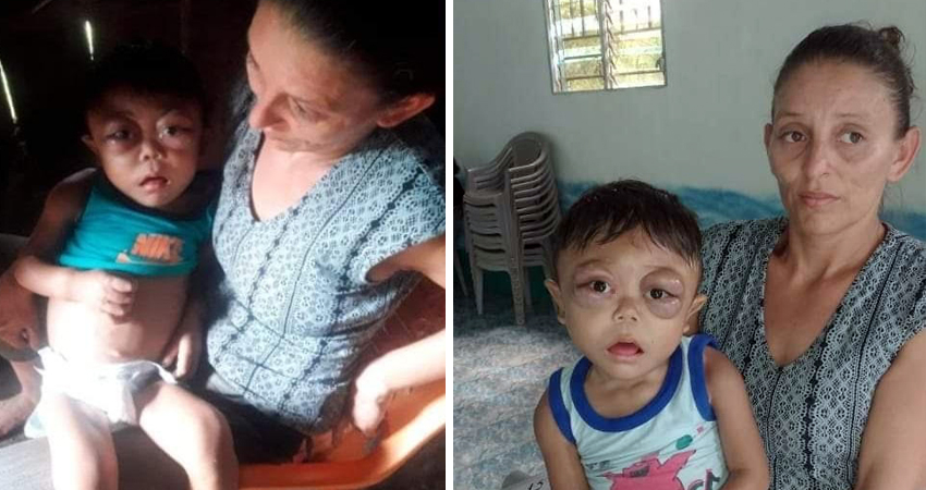 La salud del pequeño está muy deteriorada. Foto: Cortesía/Radio ABC Stereo La salud del pequeño está muy deteriorada. Foto: Cortesía/Radio ABC Stereo