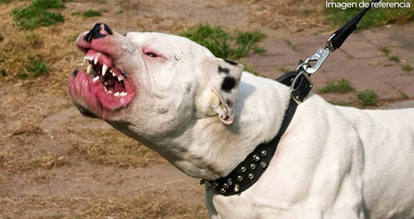 El niño de siete años fue atacado por su mascota. Foto: Imagen de referencia El niño de siete años fue atacado por su mascota. Foto: Imagen de referencia
